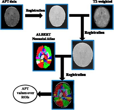 Application of amide proton transfer imaging for the diagnosis of neonatal hypoxic–ischemic encephalopathy